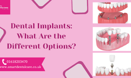 Dental Implants: What are the Different Options?