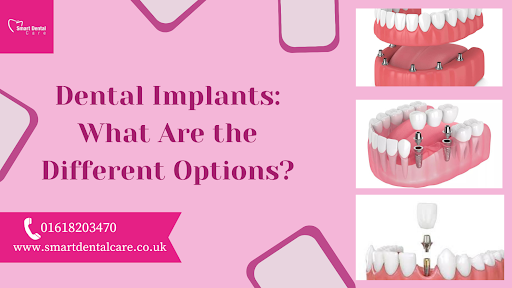 Dental Implants: What are the Different Options?